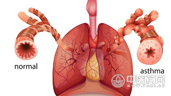 老年哮喘病的原因是什么？治疗哮喘病的药物有哪些？